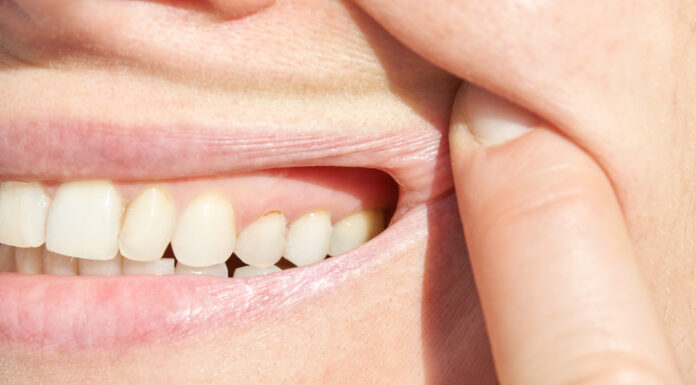 Jak znaleźć dobrego dentystę w Łodzi