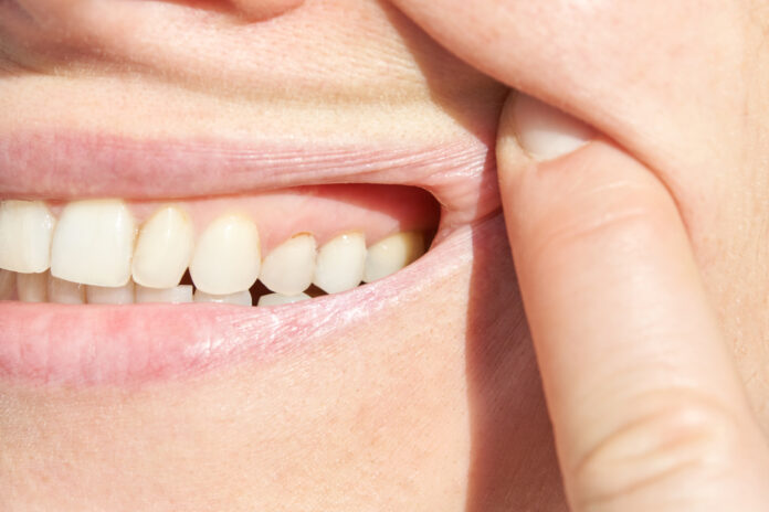 Pięć kroków do promiennego uśmiechu: Jak znaleźć dobrego dentystę w Łodzi Jak znaleźć dobrego dentystę w Łodzi